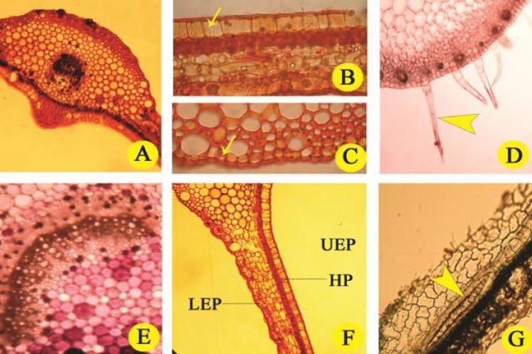 Leaf anatomy of P. heyneana leaf