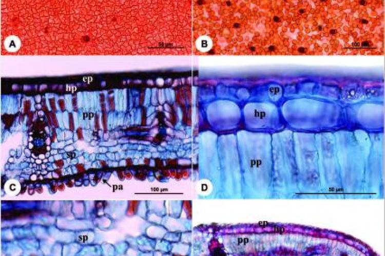 Histochemical tests in leaves and stems of Dalbergia ecastophyllum