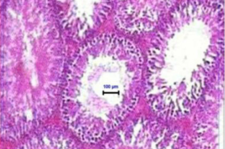 Testes of male albino rats treated with beta carotene showing normal structure of seminiferous tubules