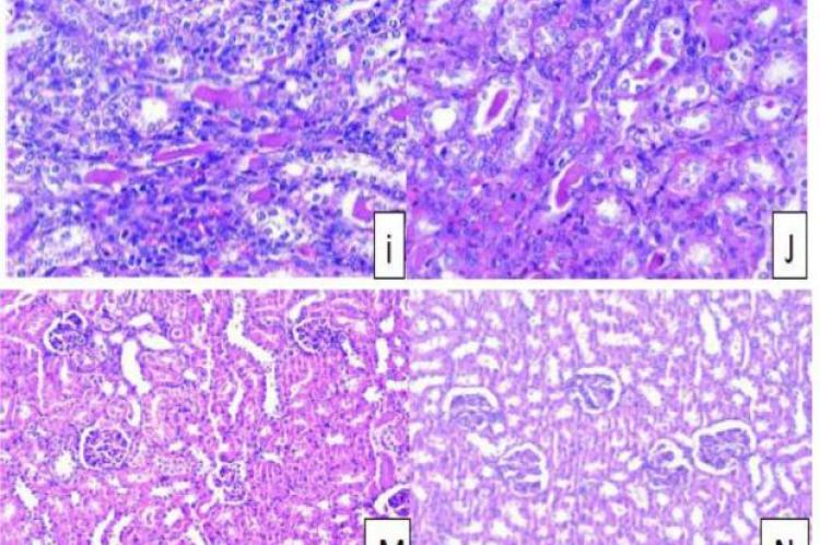 Section in kidney tissue of cisplatin -treated rat preceded by MeOH extract of C. Pepo and L. Camara