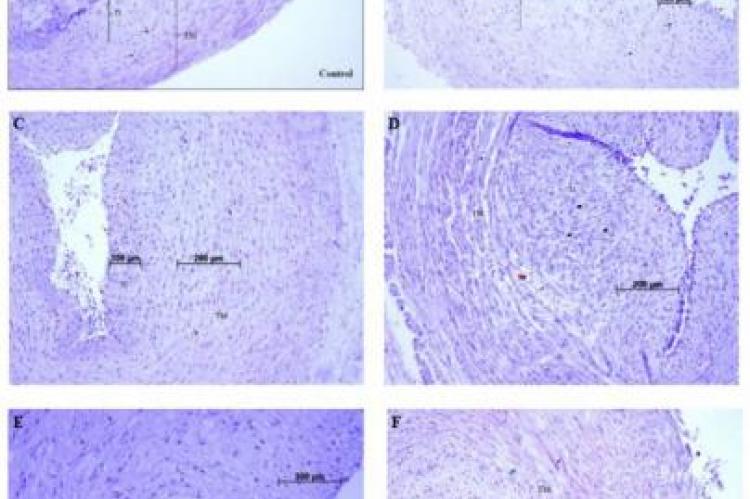 Morphological changes in HUVC