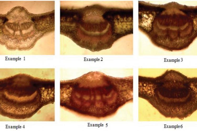 Microphotographs of an anatomic structure of a cross section of the leaf plate of six sorts of laurels noble (Laurus nobilis L.).