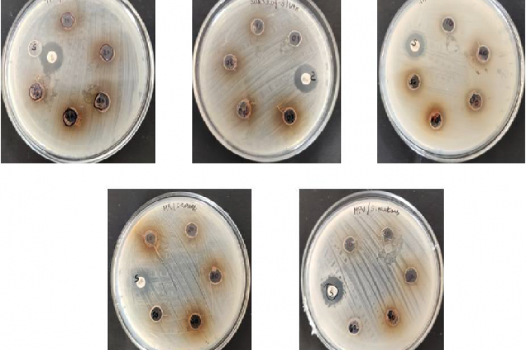 Antimicrobial activity of crude extract