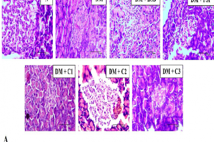 Treatments with BSB, PSP and the combination of both were able to decrease necrosis in T2DM-model rats