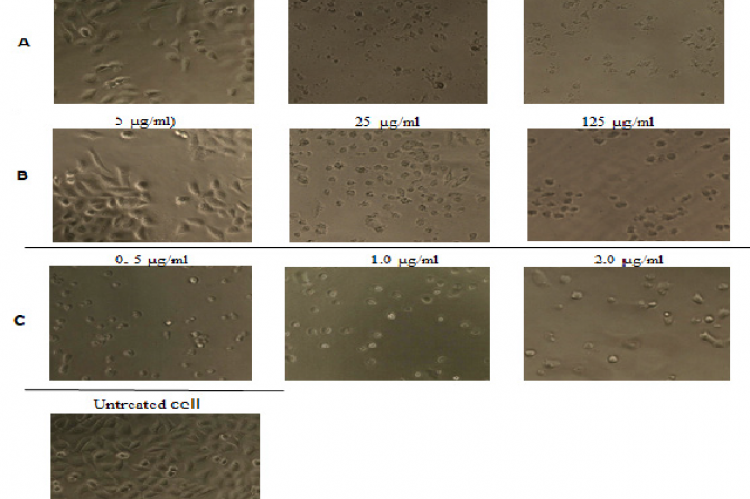 Morphology of T47D cell after treated 24 hours with methanolic extract of H. atra