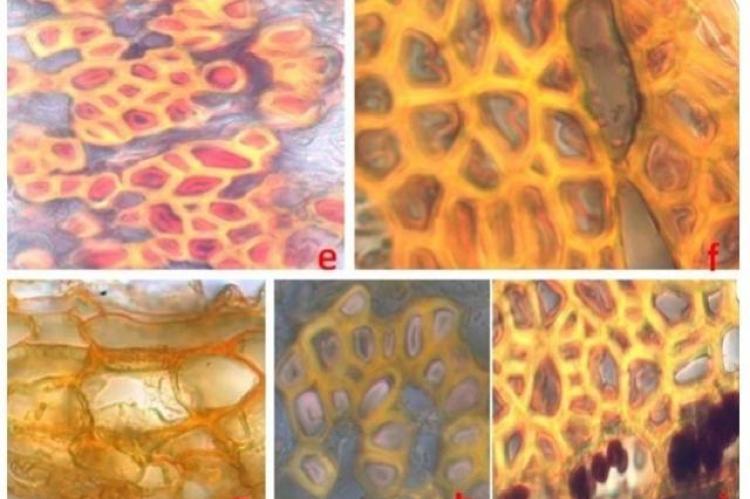 Histochemical localization studies of Indigofera tirunelvelica – root
