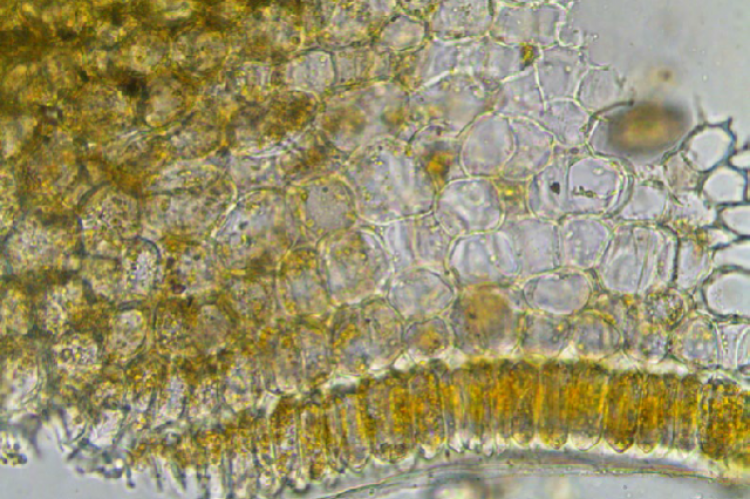 T.S. of corolla showing compactly arranged cells in small sized bud