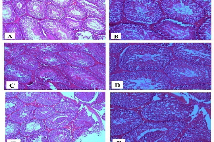 (A, B) Control (ND) rat showing normal and regular seminiferous tubules (ST) architecture; (C, D) NDEL treated rat showing no evidence of histological abnormalities, they showed normal spermatogenesis in the ST; (E,F) HFD treated rat; the seminiferous tubules displayed atrophy and vacuolation of germinal epithelium. (H&E. A, C, and F; X100. B, D and F; X 200)
