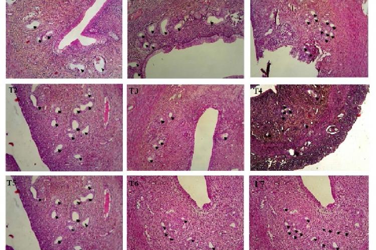 Number of endometrial glands in the cross-section of the uterus. E: Endometrial gland, M: 100 times