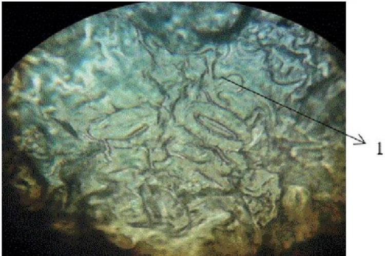 Anomocytic type stomata on transversal sectional (1)