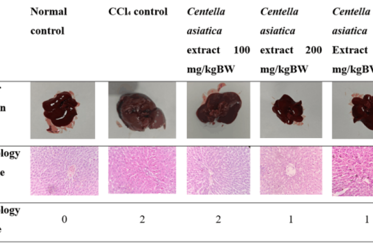 Histological Analysis of Liver Tissue in CCl₄-Induced Rats Treated with Centella asiatica extract