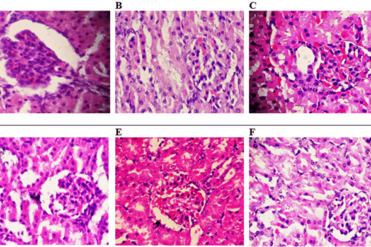 Histological Evaluation of Kidney Tissue. A) Group 1; B) Group 2; C) Group 3; D) Group 4; E) Group 5; F) Group 6.