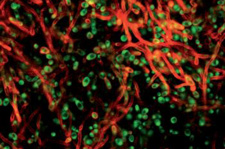 Confocal laser scanning microscopy (CLSM) image of a Candida albicans biofilm18 (Lebeaux et al., 2012)