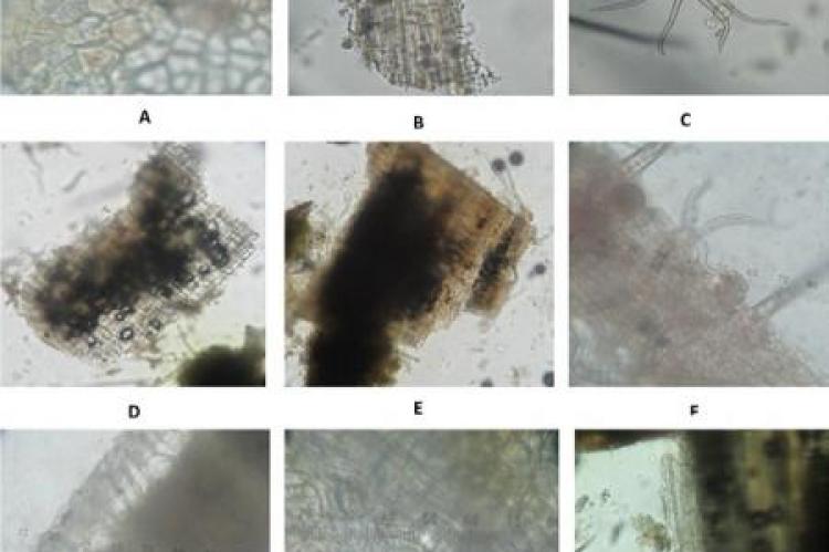 Macroscopic and Microscopic of S. macrophylla leaves powder