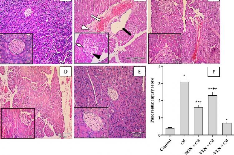 H and E (100×) of rat pancreas and islets of Langerhans