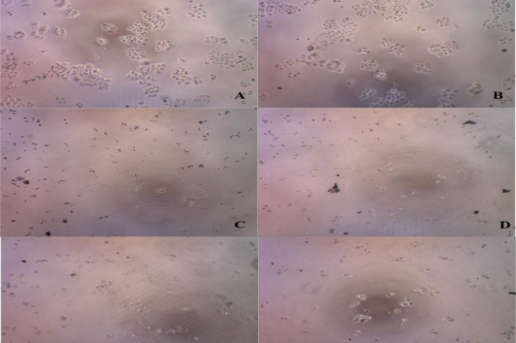 HCT116 cells observation using Dyno Eye microscope. A. Control 1, B. Control 2, C.