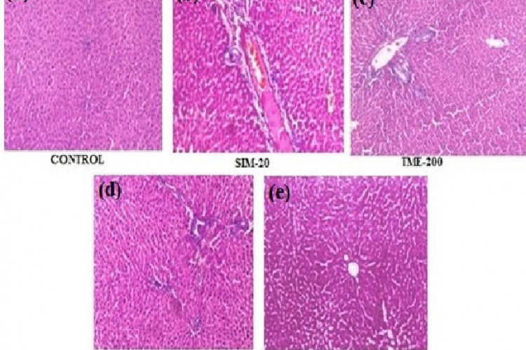 Histopathology of H&E stained sections of liver at 250X.