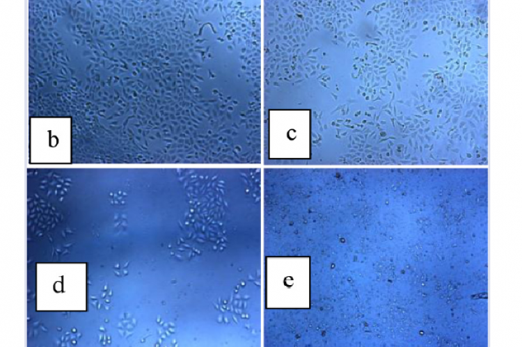 Morphological profile of the T47D cells after treated with ethanol extract of ginger 0.1 μg/mL (b), 1.0 μg/mL (c), 10 μg/mL (d) and 100 μg/mL (e) compared to control (a) for 24 h. (100 x enlargement)