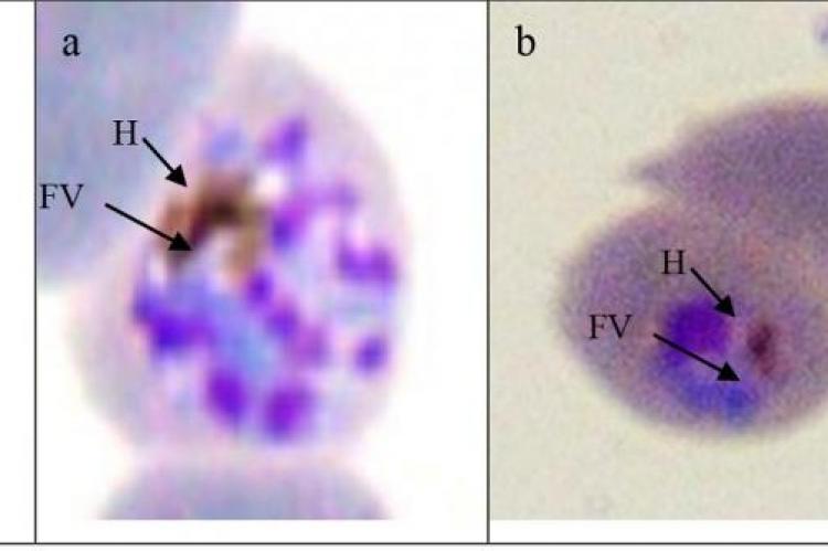 Morphology of P. falciparum food vacuole