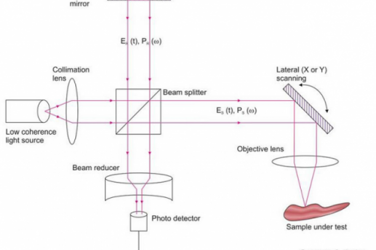 Optical coherence tomography uses light to generate highresolution Images of tissues