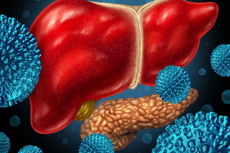 Progression of hepatitis B.