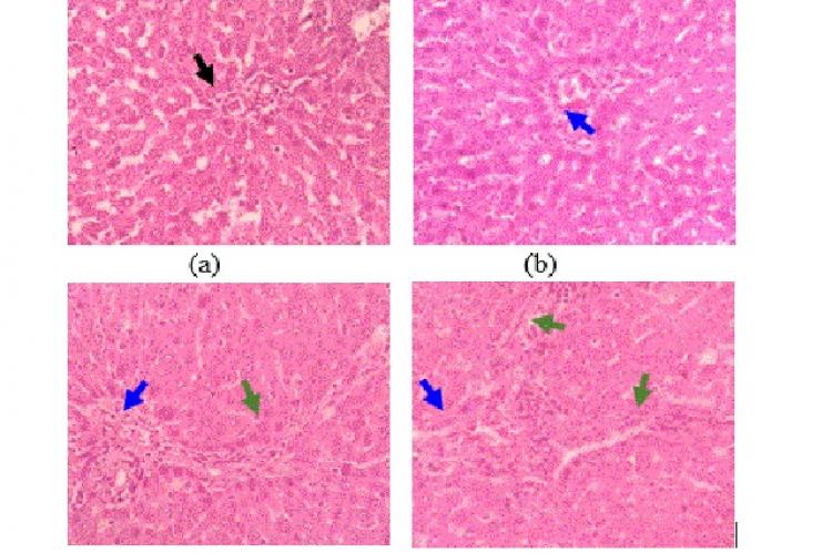 Histopathological examination (HE, 400x) of liver’s male rats in a subchronic oral toxicity stud