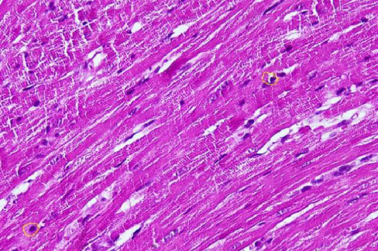 Myocardial Preparations in the Negative Control Group (Magnification 40x10). Neutrophils counted are those in the Yellow Circle