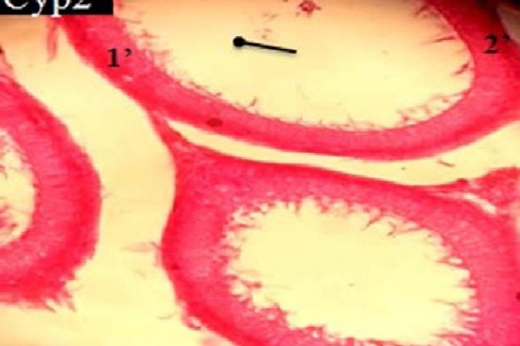 Photomicrography of transverse section in the epididymis tubules