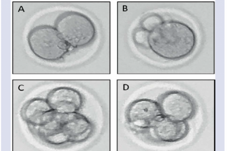 Embryo development on Day-1: A) good quality, B) poor quality and Day-3: C) good quality, D) poor quality.