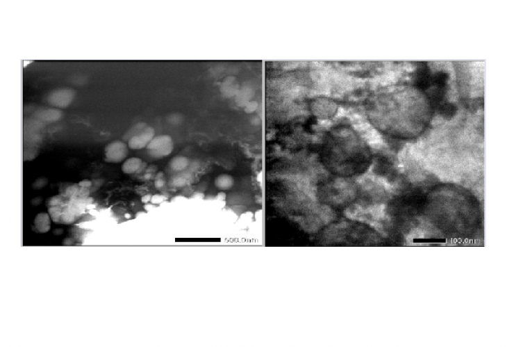 TEM results at 10,000 times magnification of liposome ethanol extract of tekelan leaves (C. odorata L.) formulation-3 with sonication time 30 minutes (a) before purification, (b) after purification.