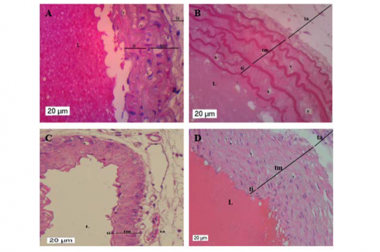 Figure 1: Histopathology of the aortic vessels in each treatment group. A. The group with distilled water at a dose of 0.39 ml/20 g body weight (negative control), B. The group with the dragon fruit peel extract at a dose of 5.40 mg/20 g body weight, C. The group with the dragon fruit peel extract at a dose of 10.80 mg/20 g body weight, and D. The group with simvastatin at a dose of 0.026 mg/20 g body weight (positive control). HE. 40x. bar= 20 μm. {(L= lumen) (ti= tunica intima) (tm= tunica media) (ta= tun