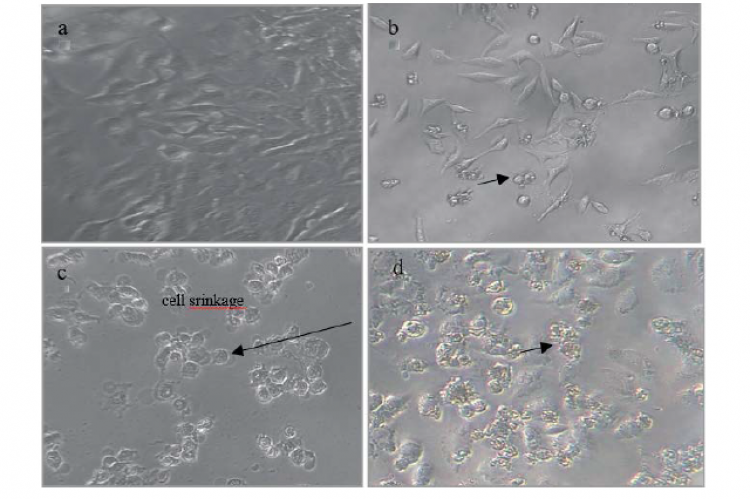 Morphological changes showing of HeLa cell line. (a) control cell; (b) treatment with aqueous fraction; (c) treatment with ethyl acetate