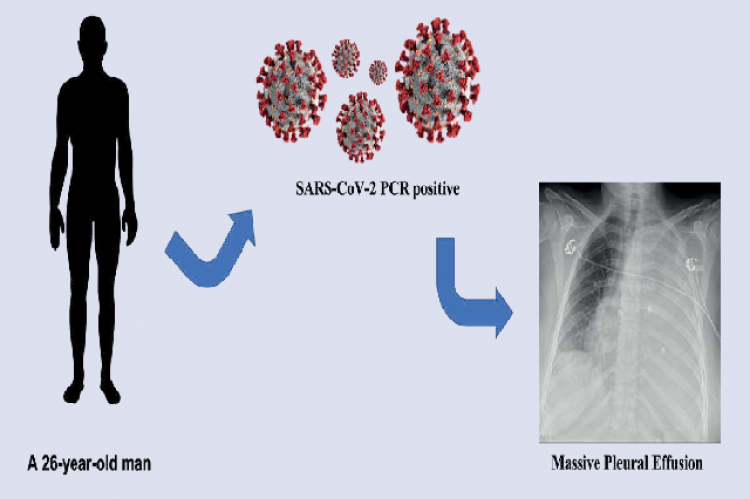 Graphical Abstract 