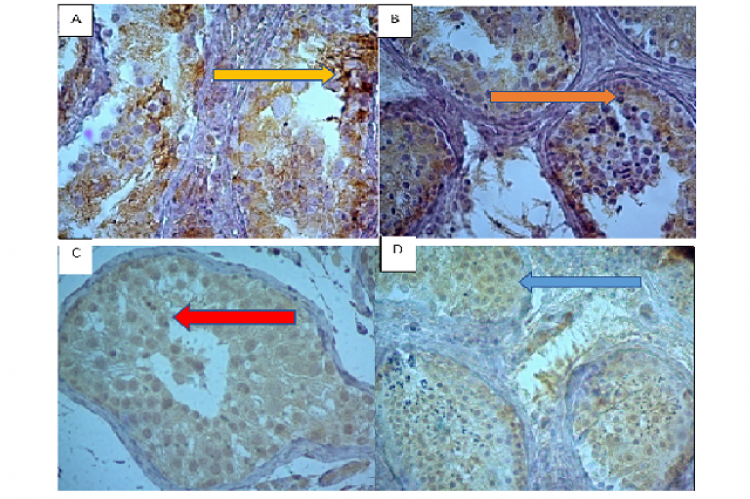 LH receptor expression in male testicular cells with NOA. A.