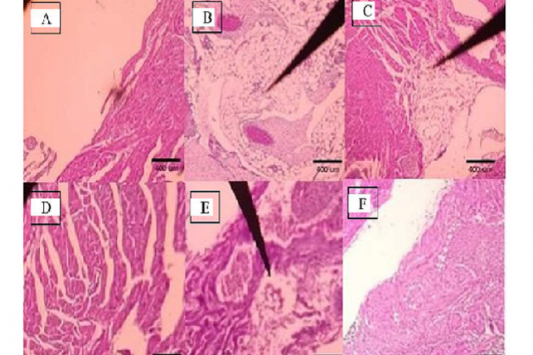 Cardiac morphology of mice. A. control, B. Obese0, C. Obese2, D. Obes7, E. Obese14, F. Obese21.