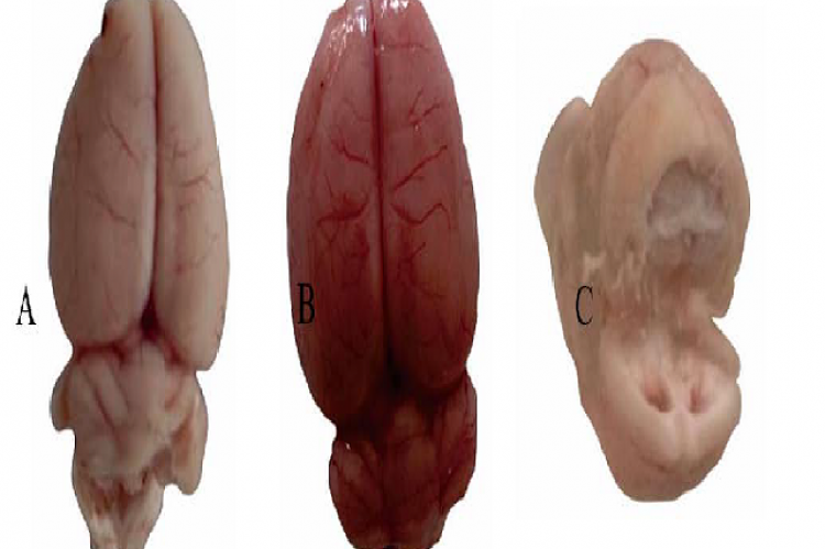 Picture of brain gross anatomy (A) brain after induction of kaolin 7th