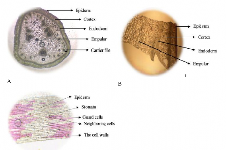 Microscopic results of B. rubra L. stem; (A) Transverse cross -section; (B) Longitudinal cross -section;