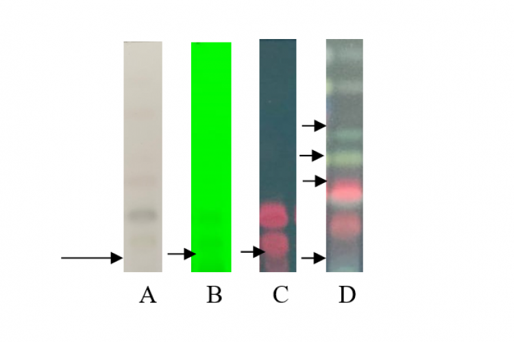 The appearance of TLC stains. A. TLC plate with white light after spraying with H2SO4, B. TLC plate under UV light of λ 254 nm