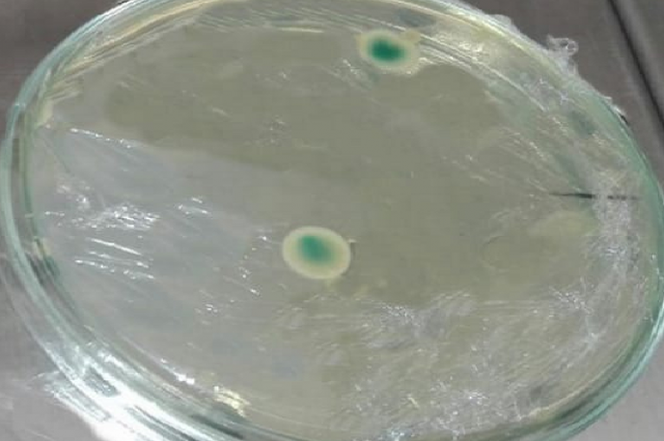 Colonies in blue are bacterial colonies that failed to insert a plasmid so that the lac portion of the bacterial plasmid is damaged and causes a blue colour