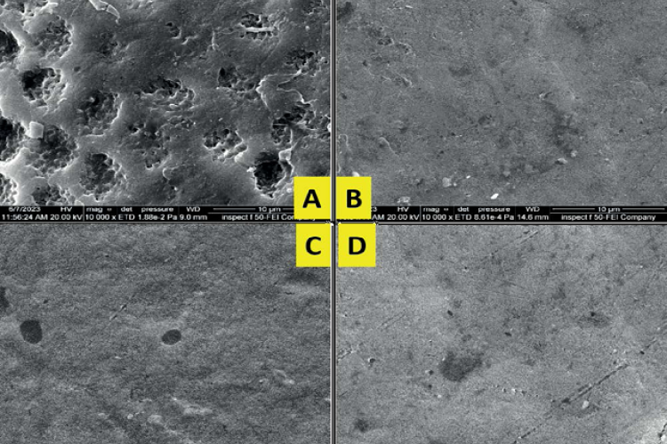 SEM images (10000x) of the enamel surface treated with (A) deionized water after bleaching (Control, BT1) displayed morphological alterations