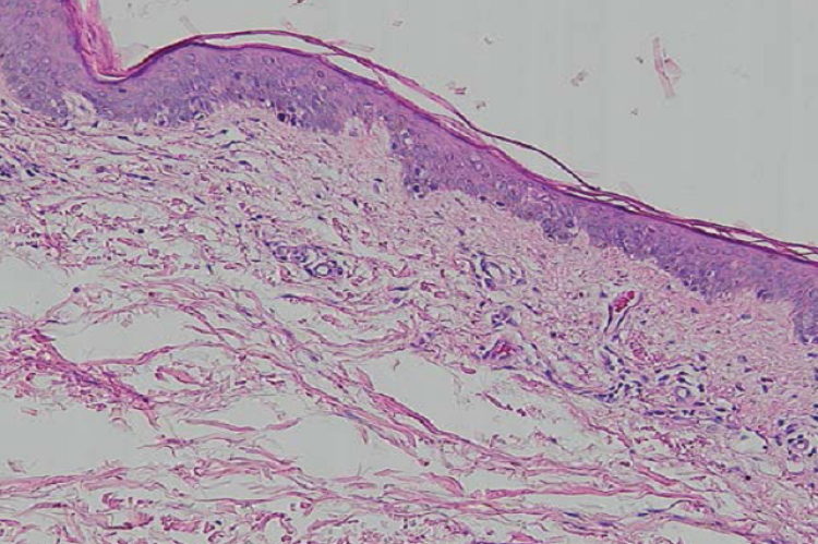 Histopathological examination