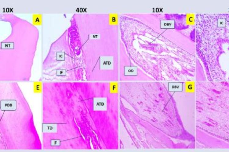 A representative images of the pulp tissues at first week of the control versus ACC group after sectioning and staining with hematoxylin and eosin.