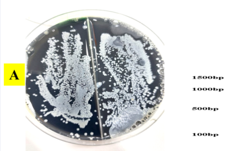  The positive isolates of legionella pneumophila