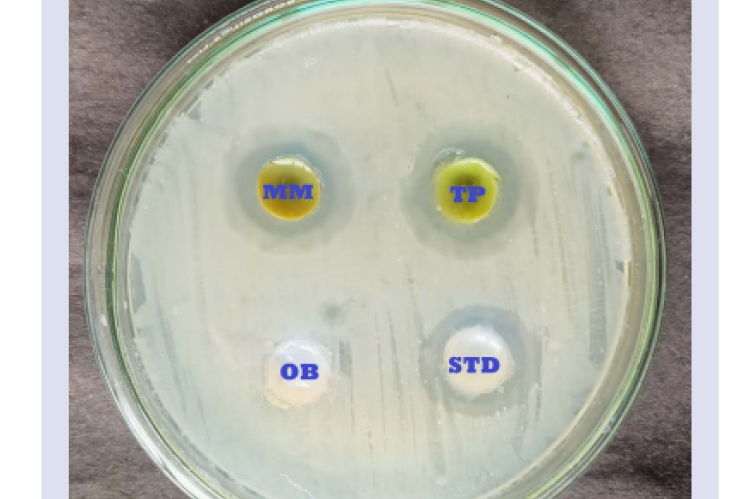 Antistaphylococcus activity of herbal formulations; MM -  Mikania micrantha ointment, TP- Tridax procumbens ointment, STD -  Standard drug Supragent, OB - Ointment base.