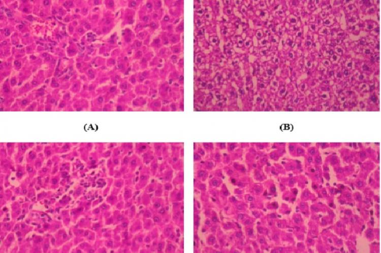 e 1: Histological morphology of rat livers after 10 days of treatment with ethenolic extract of Tectona grandis bark