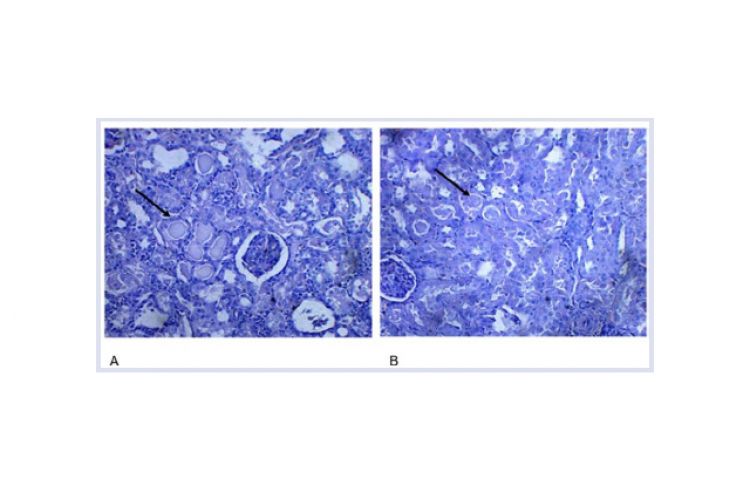 Photomicrograph of kidney sections treated with aqueous extract of Pimpinella anisum at doses 1 and 2 g/kg: showing granular casts (black arrow) and degenerated tubular epithelium (40X, H &E).