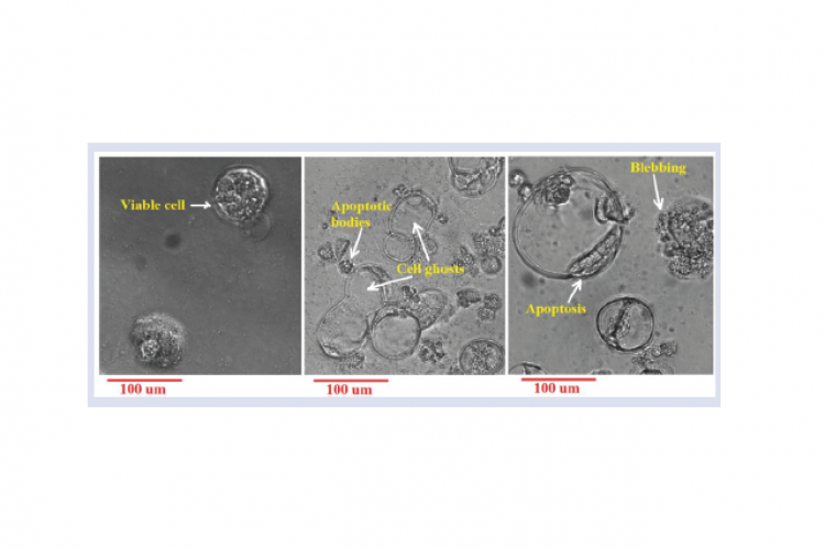 Effects of T. sericea extracts on the morphological characteristics of Caco2 cells: (a)