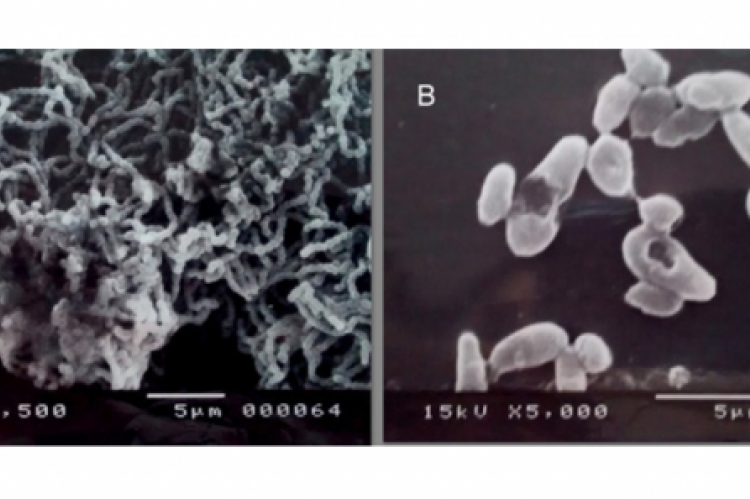 Scanning electron microscopy (SEM) images of Streptotoccus mutans biofilms. Biofilms emerged after 24-hour incubation in 12-well plates.