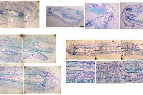 Pharmacognostic studies and Nephroprotective potential of Trichosanthes cucumerina