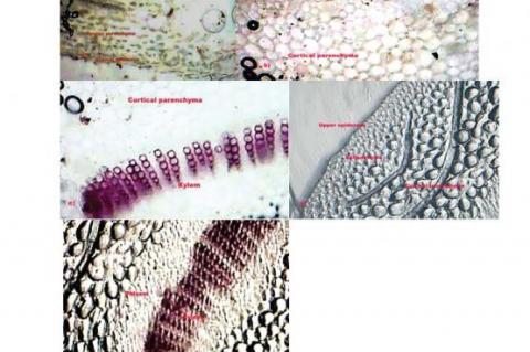 Microscopical characteristics of S. indiucs leaf